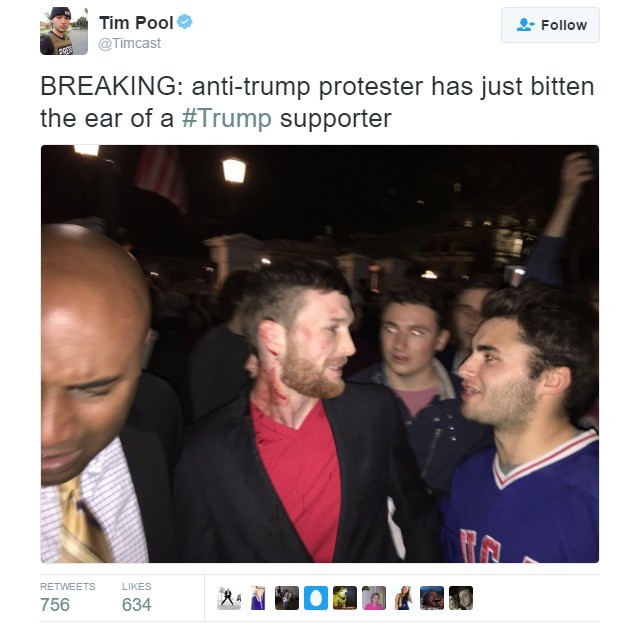 Anti+trump+protester+bit+a+man.jpg